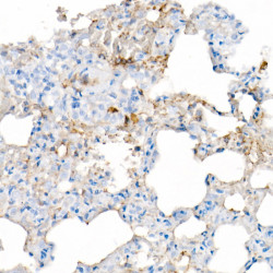 IL-6 Rabbit mAb