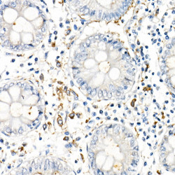TNF-α Rabbit mAb