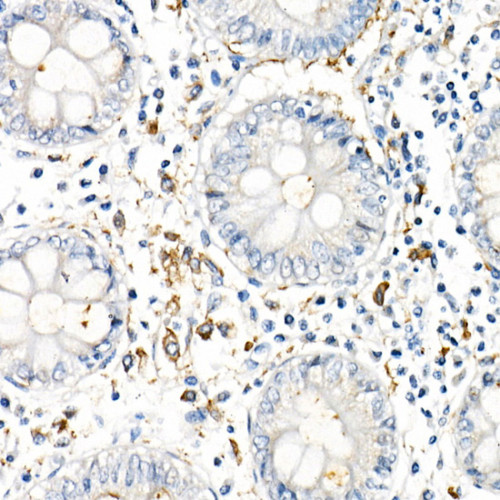 TNF-α Rabbit mAb