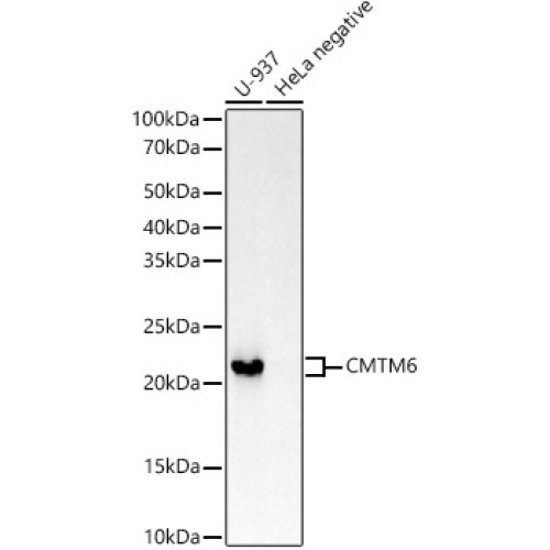 CMTM6 Rabbit mAb