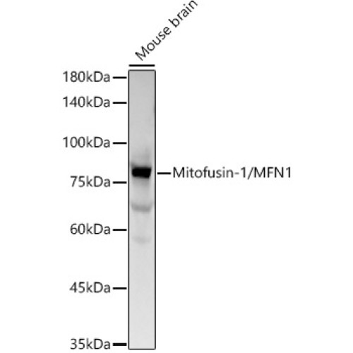 Mitofusin-1/MFN1 Rabbit mAb