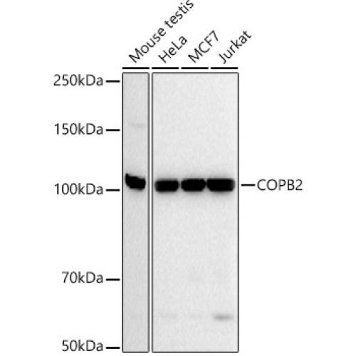 COPB2 Rabbit mAb