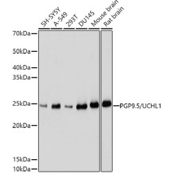 PGP9.5/UCHL1 Rabbit pAb