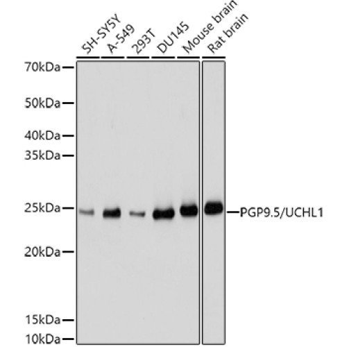 PGP9.5/UCHL1 Rabbit pAb