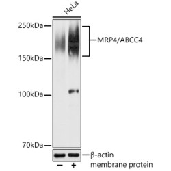 MRP4/ABCC4 Rabbit pAb
