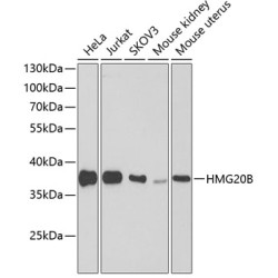 HMG20B Rabbit pAb