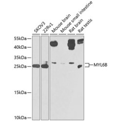 MYL6B Rabbit pAb