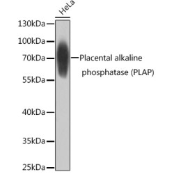 Placental alkaline phosphatase (PLAP) Rabbit pAb