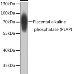 Placental alkaline phosphatase (PLAP) Rabbit pAb