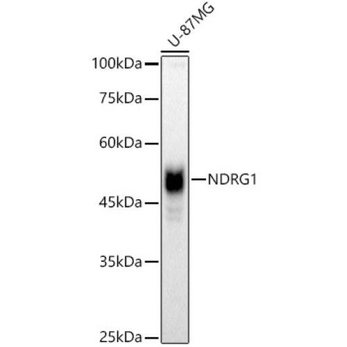[KO Validated] NDRG1 Rabbit pAb