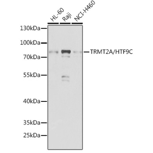 TRMT2A/HTF9C Rabbit pAb