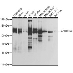 ANKRD52 Rabbit pAb