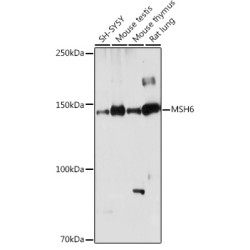 [KO Validated] MSH6 Rabbit pAb