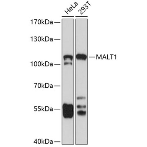 MALT1 Rabbit pAb