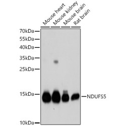 [KD Validated] NDUFS5 Rabbit pAb