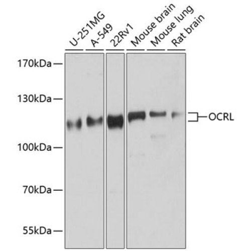 OCRL Rabbit pAb