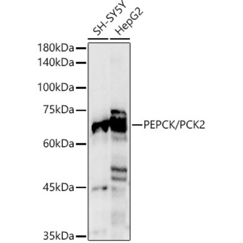 [KO Validated] PEPCK/PCK2 Rabbit pAb