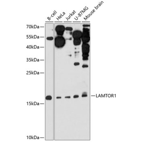 LAMTOR1 Rabbit pAb