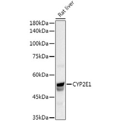 CYP2E1 Rabbit pAb