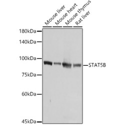 [KO Validated] STAT5B Rabbit pAb
