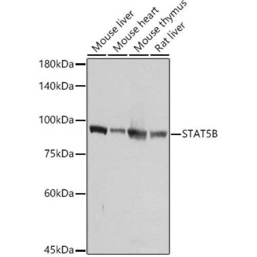 [KO Validated] STAT5B Rabbit pAb