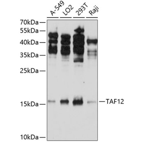 TAF12 Rabbit pAb