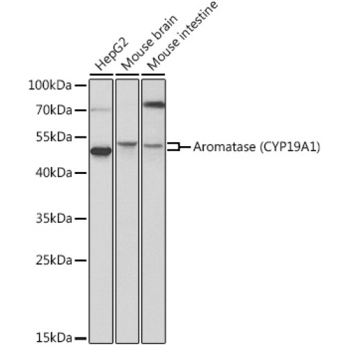 Aromatase (CYP19A1) Rabbit pAb