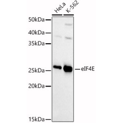 [KD Validated] eIF4E Rabbit pAb