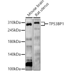 TP53BP1 Rabbit pAb