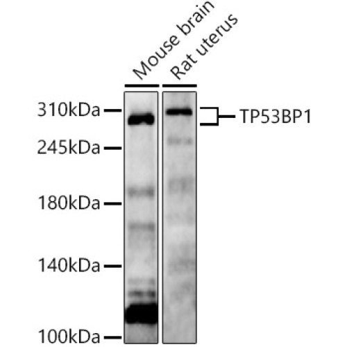 TP53BP1 Rabbit pAb