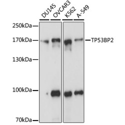 TP53BP2 Rabbit pAb