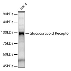 Glucocorticoid Receptor Rabbit pAb