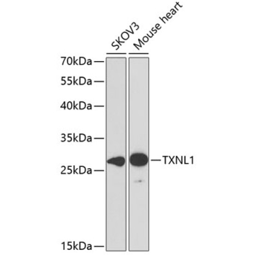 TXNL1 Rabbit pAb