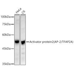 Activator protein 2 (AP-2/TFAP2A) Rabbit pAb