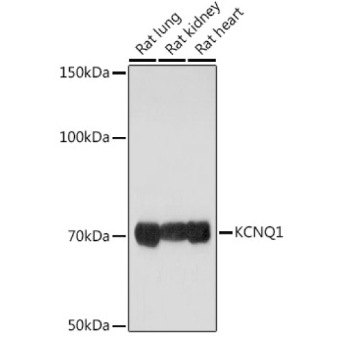 KCNQ1 Rabbit pAb