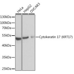 Cytokeratin 17 (KRT17) Rabbit pAb