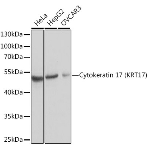 Cytokeratin 17 (KRT17) Rabbit pAb
