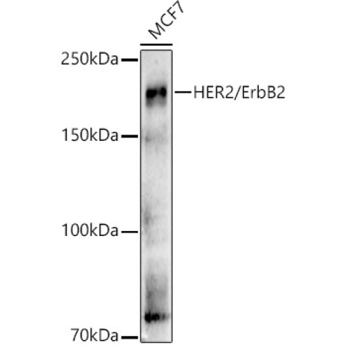 [KO Validated] HER2/ErbB2 Rabbit pAb
