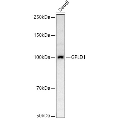 [KD Validated] GPLD1 Rabbit pAb