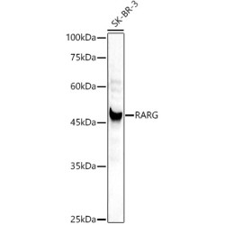 [KD Validated] RARG Rabbit pAb
