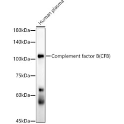 Complement factor B (CFB) Rabbit mAb