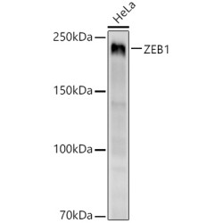 ZEB1 Rabbit mAb