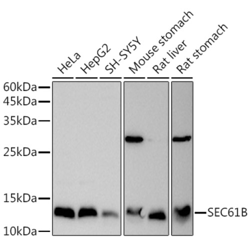 SEC61B Rabbit pAb