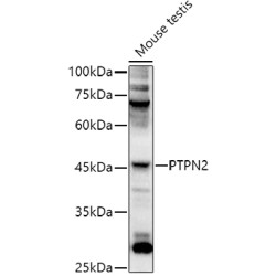 PTPN2 Rabbit pAb