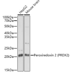 Peroxiredoxin 2 (PRDX2) Rabbit pAb
