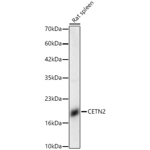CETN2 Rabbit pAb