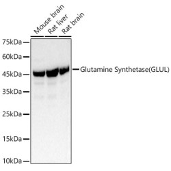 Glutamine Synthetase (GLUL) Rabbit pAb