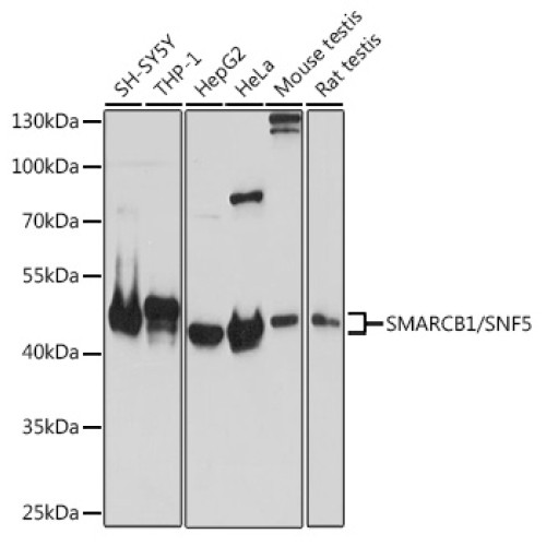 SMARCB1/SNF5 Rabbit pAb