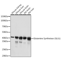 Glutamine Synthetase (GLUL) Rabbit mAb