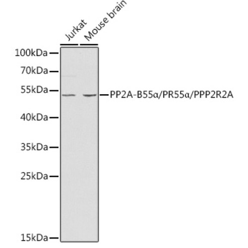 PP2A-B55α/PR55α/PPP2R2A Rabbit pAb